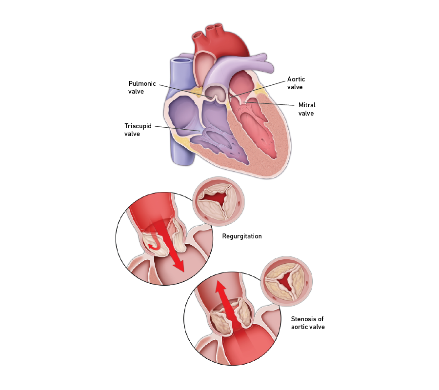 Heart valves: Diagrams, types, function, diseases, and more