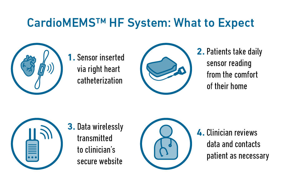 CardioMEMS HF System and what to expect