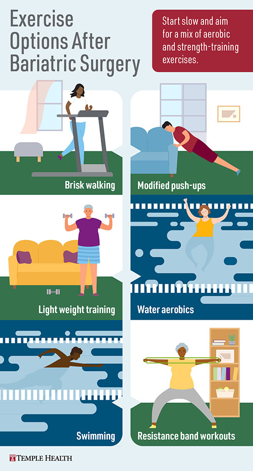 Exercise Options After Bariatric Surgery