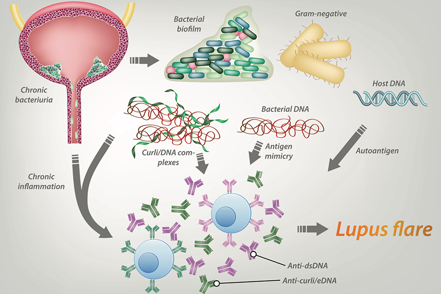 Lupus Flare Research Model