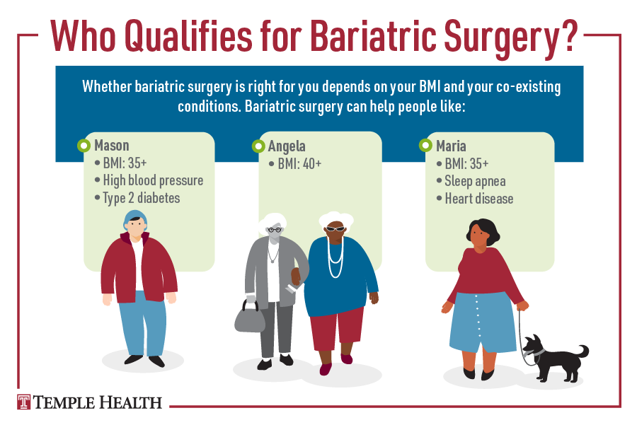 Who Qualifies for Bariatric Surgery