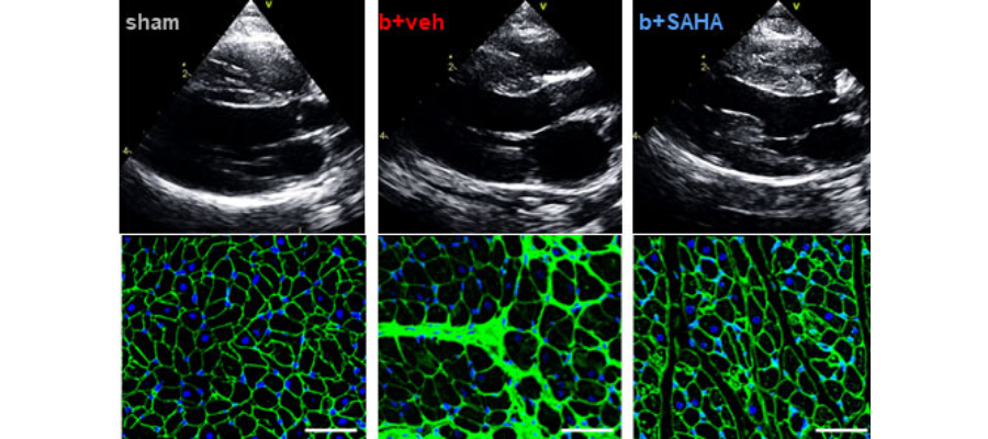Echocardiogram