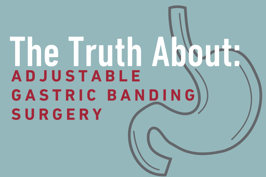 Adjustable Gastric Banding Surgery graphic