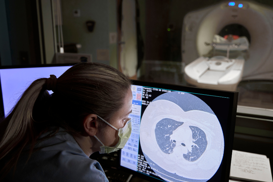 LDCT scan
